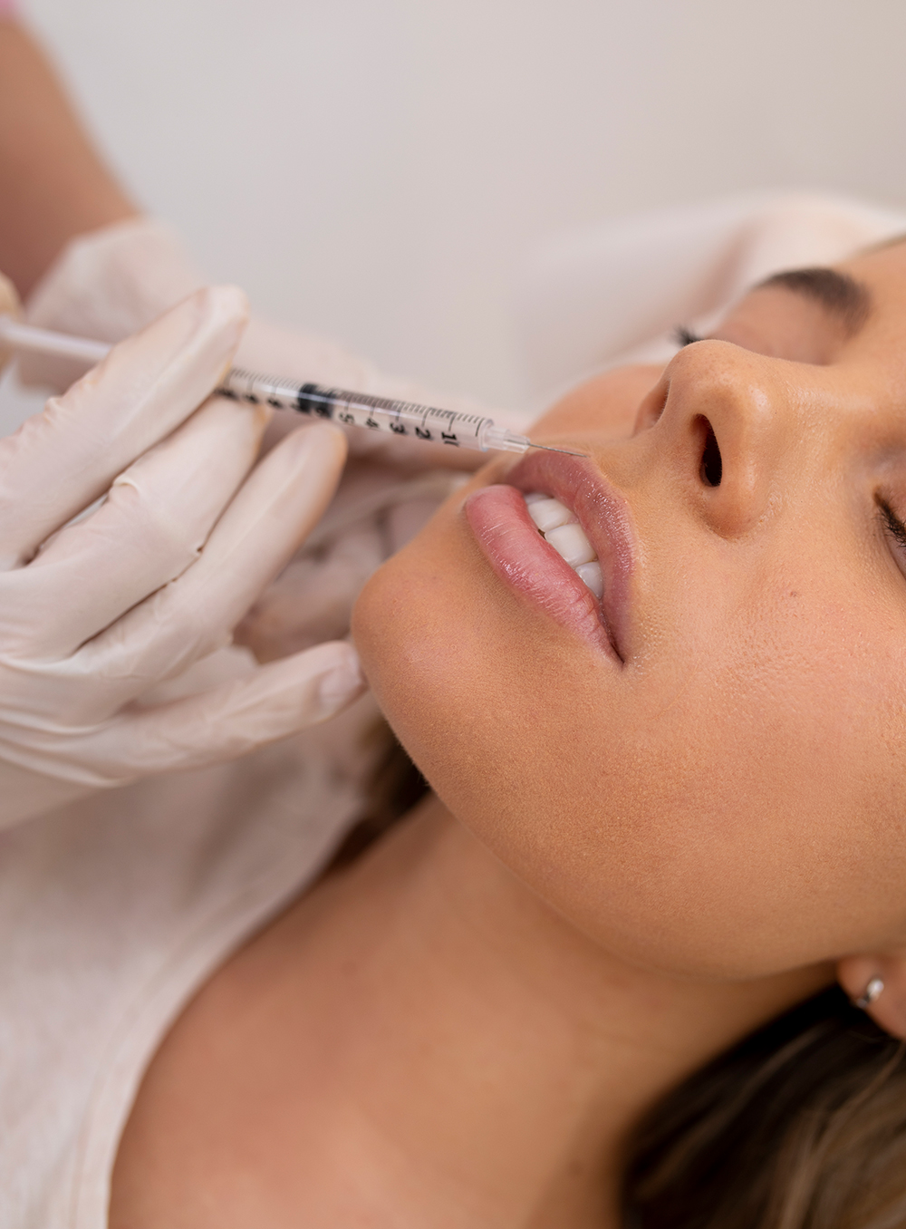 Close-up portrait of a young brunette woman with hoop earrings undergoing lip filler treatment in a clinic, as a gloved hand holds a syringe injecting dermal filler into her parted lips.